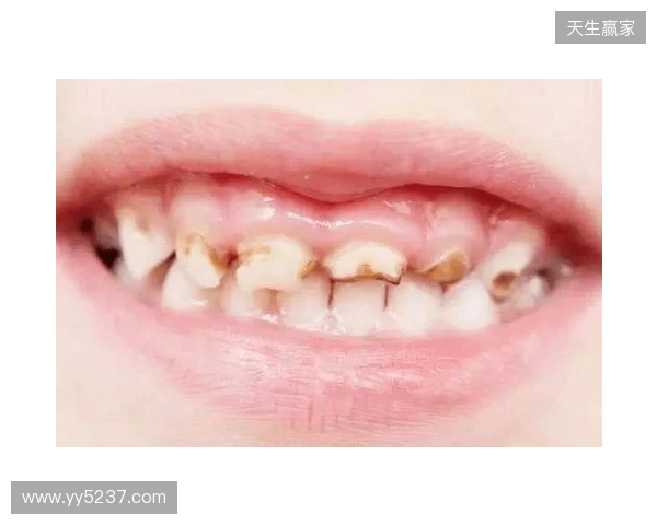 韦林顿确诊上唇部贯通伤;11、21牙半脱位;上颌前牙区牙槽骨骨折 韦林顿确诊上唇部贯通伤;11、21牙半脱位;上颌前牙区牙槽骨骨折